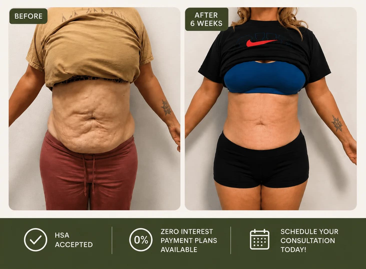 SK Longevity 12-week transformation program comparison.